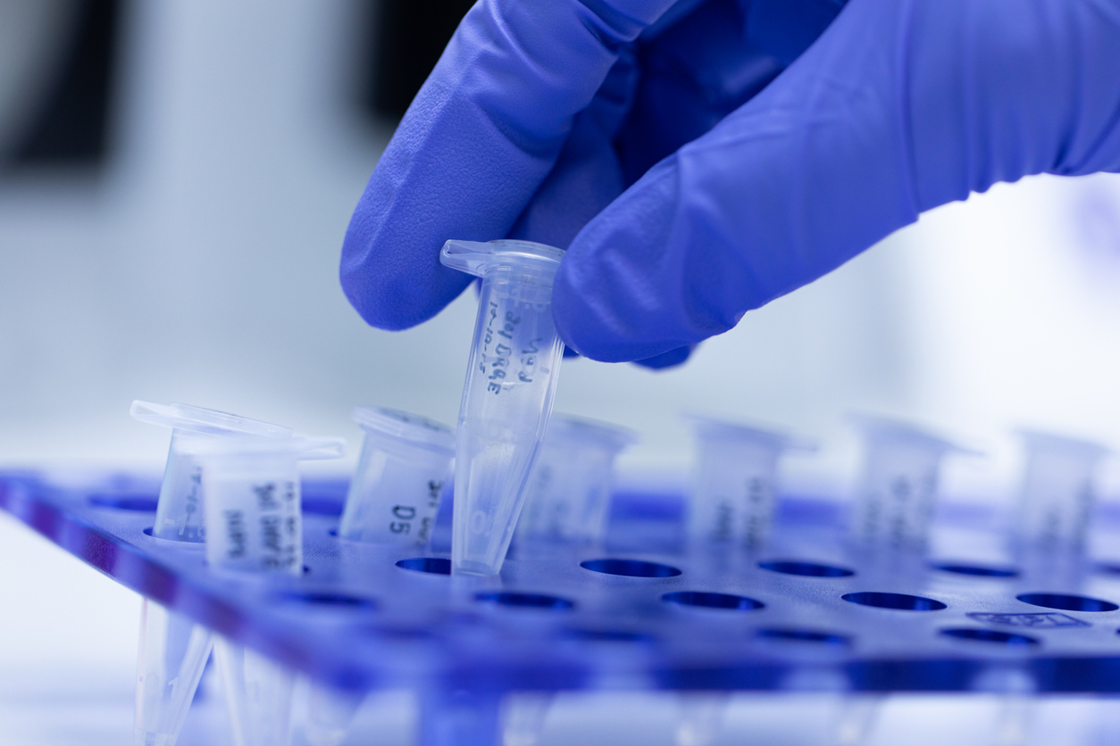 A guide to common sterile processing contaminants