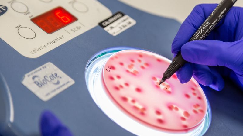 The evolving role of a contamination control strategy in Annex 1