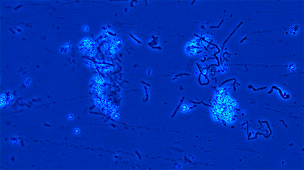 <i>B. cereus</i> spore suspension under 40X magnification using phase contrast microscope